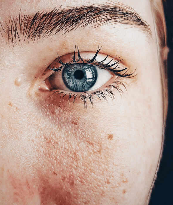 Skin Retouch Levels Demo