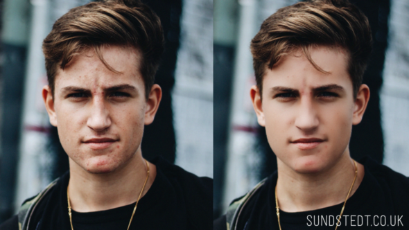 Skin Retouch Example Spots